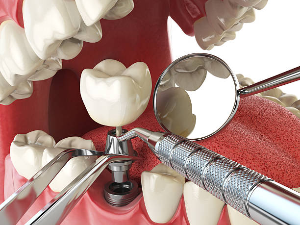 Best Emergency Orthodontic Repairs in Pandora, OH