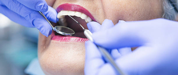 Best Emergency Tooth Extraction in Pandora, OH